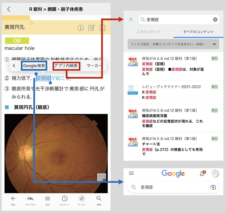 電子版「レビューマイナー」本日発売！ | INFORMA by メディックメディア