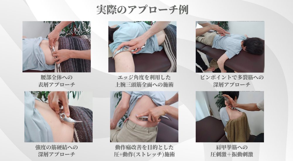 IASTM-Feather™の特徴 | 【IASTM筋膜リリース認定資格セミナー】日本