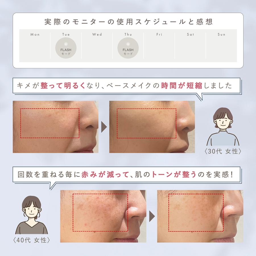 LINKA（リンカ） 美顔器 光美容器 スノー フラッシュ DPL/NIR ブライト