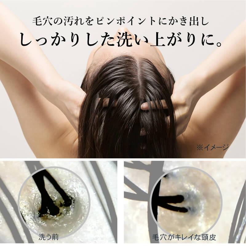 MYTREX（マイトレックス） EMS へッドスパ プロ ヘッドマッサージ 送料