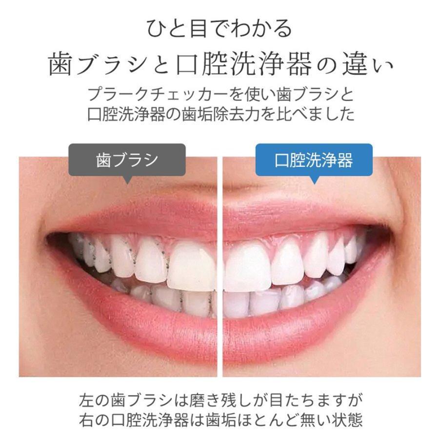 正規品 口腔洗浄器 ジェットウォッシャー 歯垢除去 強弱切り替え 口内