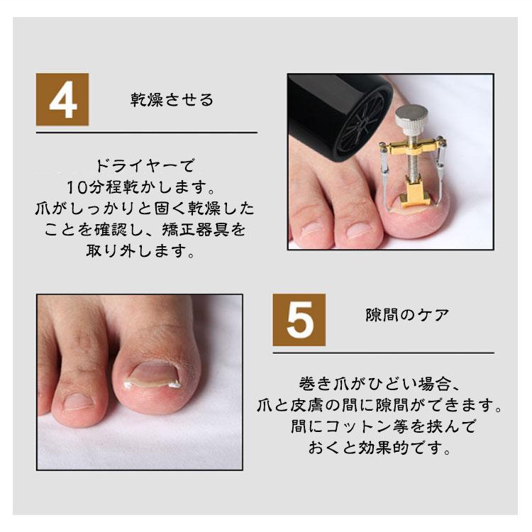 巻き爪 矯正 2個セット 収納ケース付き サポート 器具 ネイルケア