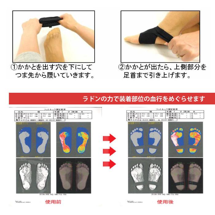 爆買 エナジーラバー メディカルホールドGBスポーツ ER-M02GB 足用