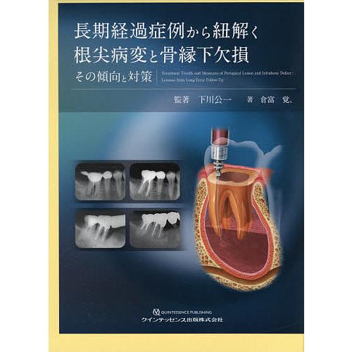 長期経過症例から紐解く根尖病変と骨縁下欠損 その傾向と対策/下川公一