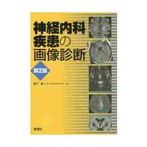 神経内科疾患の画像診断 第2版 / 柳下 章 著 : 京都 大垣書店
