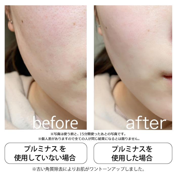 JAPAN GALS（ジャパンギャルズ） 公式 丸洗い出来る美顔器 mous