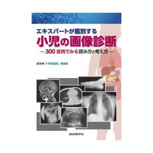 エキスパートが鑑別する小児の画像診断 300症例でみる読み方と考え方