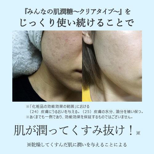 北の快適工房 みんなの肌潤糖〜クリアタイプ〜 ニキビ肌を防ぐ