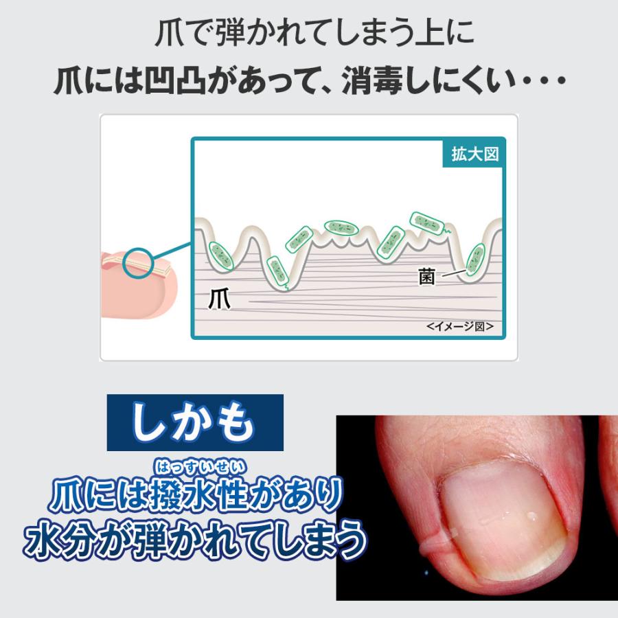 北の快適工房 公式 ニッパー 付き 特別セット クリアストロング