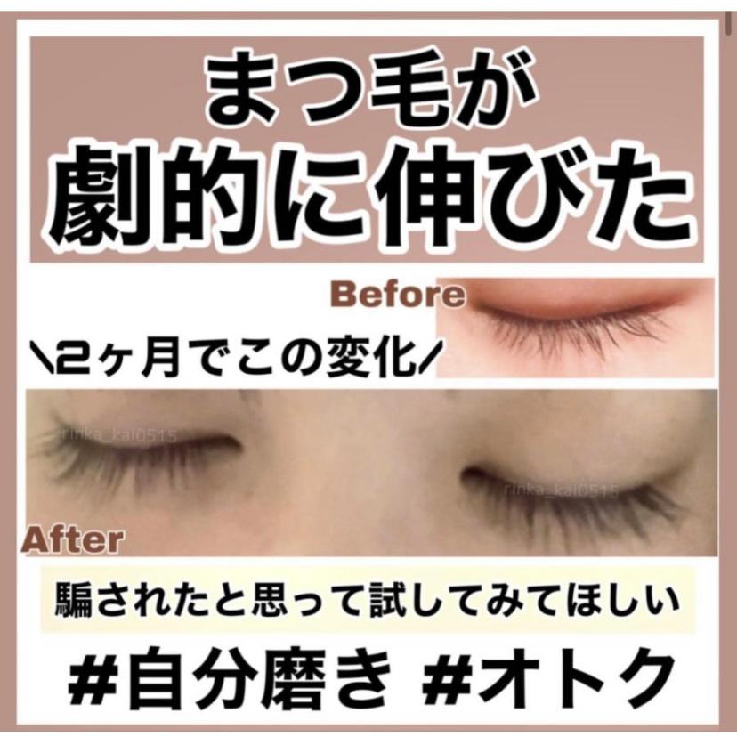 本日限定価格 エマ―キット 2ml まつげ美容液 QRコード付き : one's