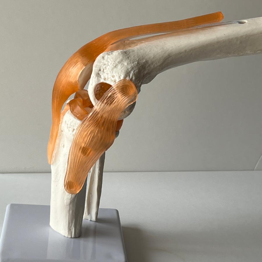 医学模型 膝関節模型 膝関節症 膝の痛み 膝関節可動解剖学模型 : 人体