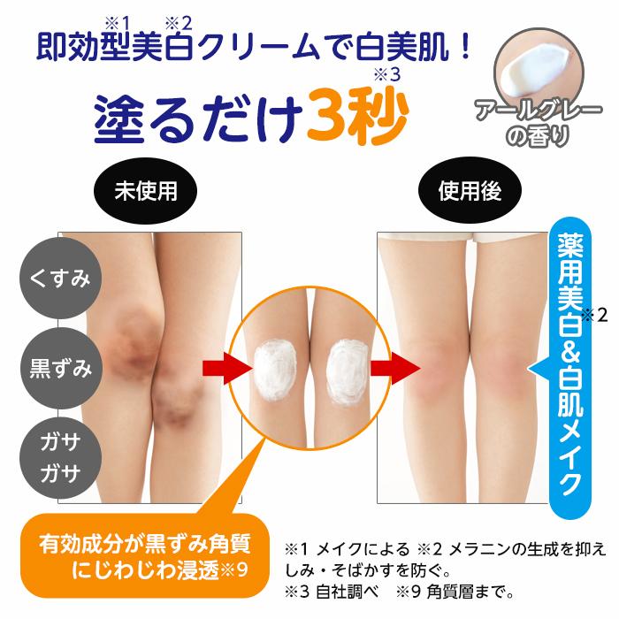 Sun Smile（サンスマイル） 薬用 美白クリーム 白い膝人 30g 膝 黒ずみ