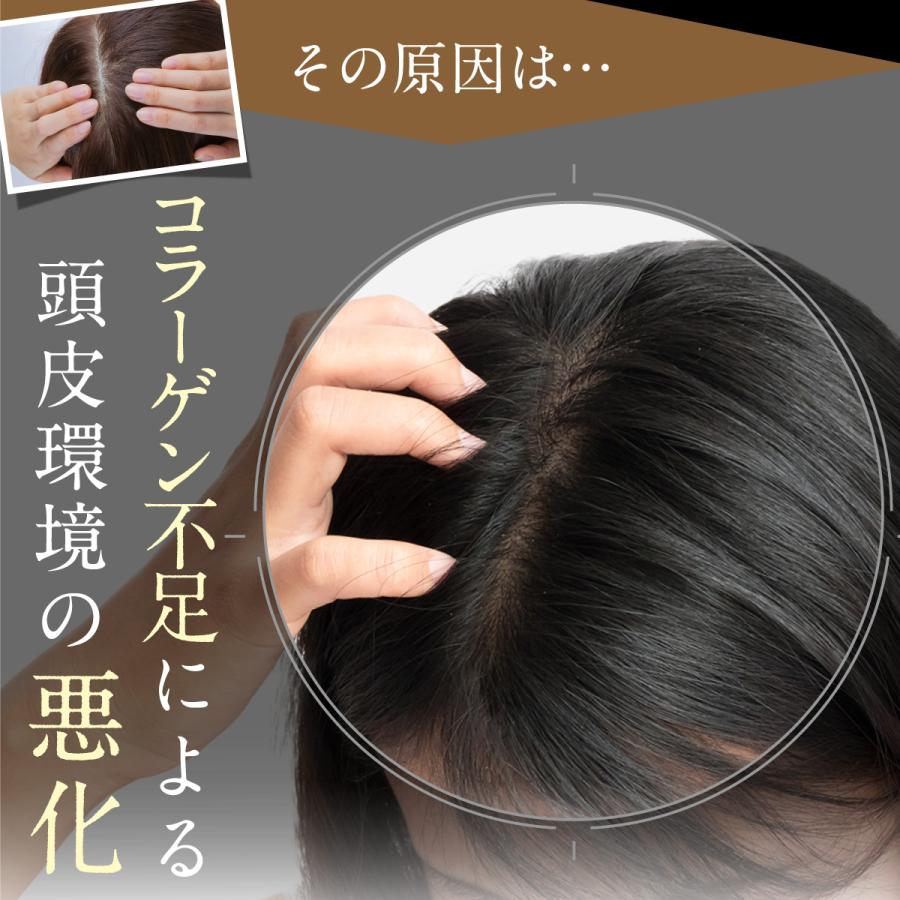 シャンプー ボトル【公式】ノ・アルフレ オールインワン アミノ酸 ノン