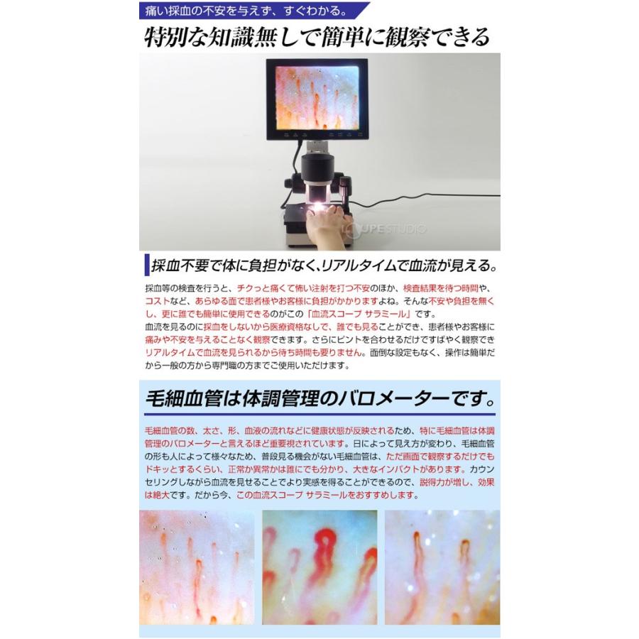 顕微鏡 血流スコープ サラミール 血管 検査 毛細血管 無採血 血流計測