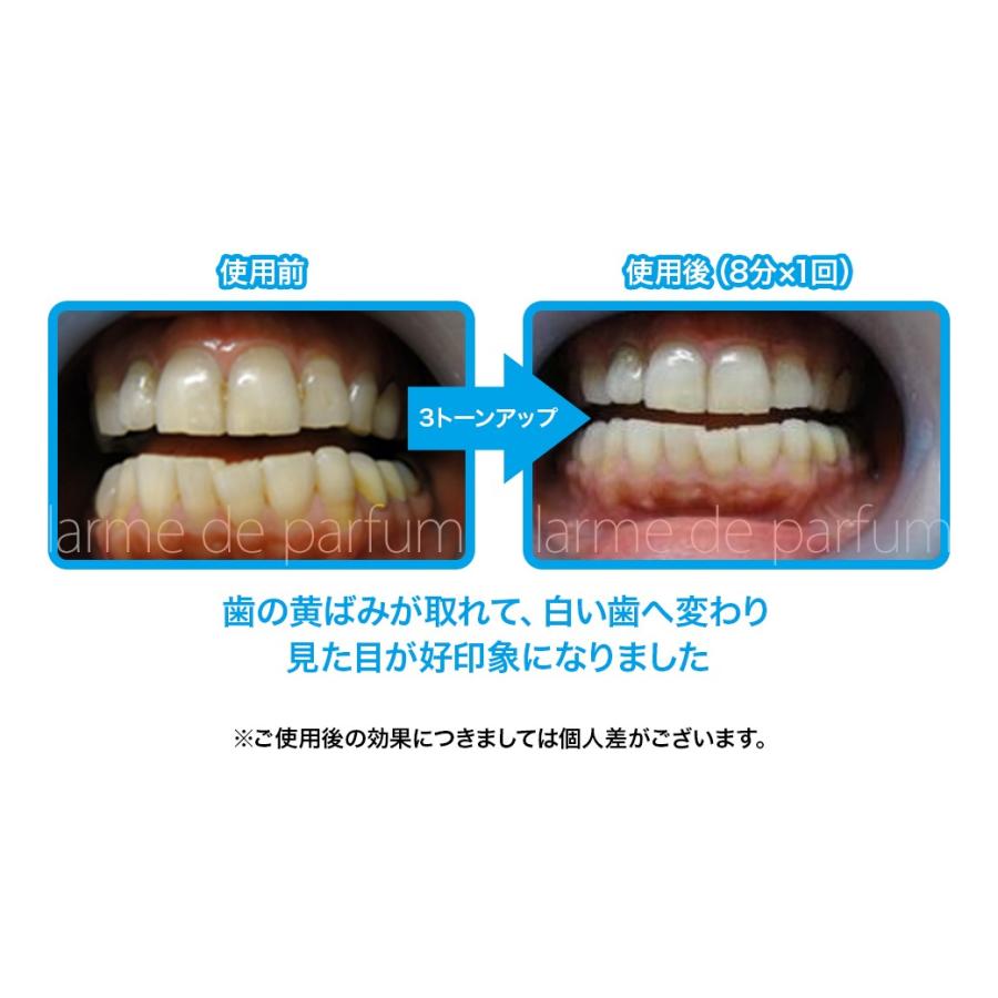 正規品】 ドクターホワイト 専用溶剤4本セット約15回分 医薬部外品