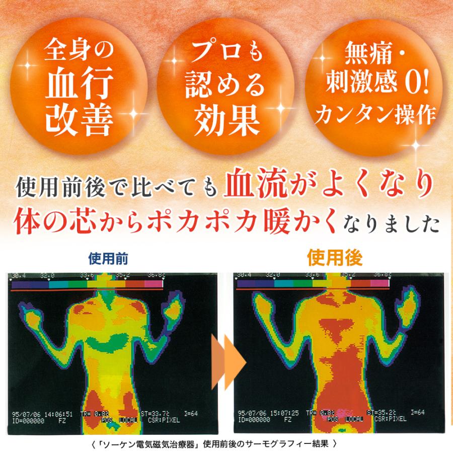 電気（交流）磁気治療器 ソーケン 6型 延長保証付 ソーケンメディカル