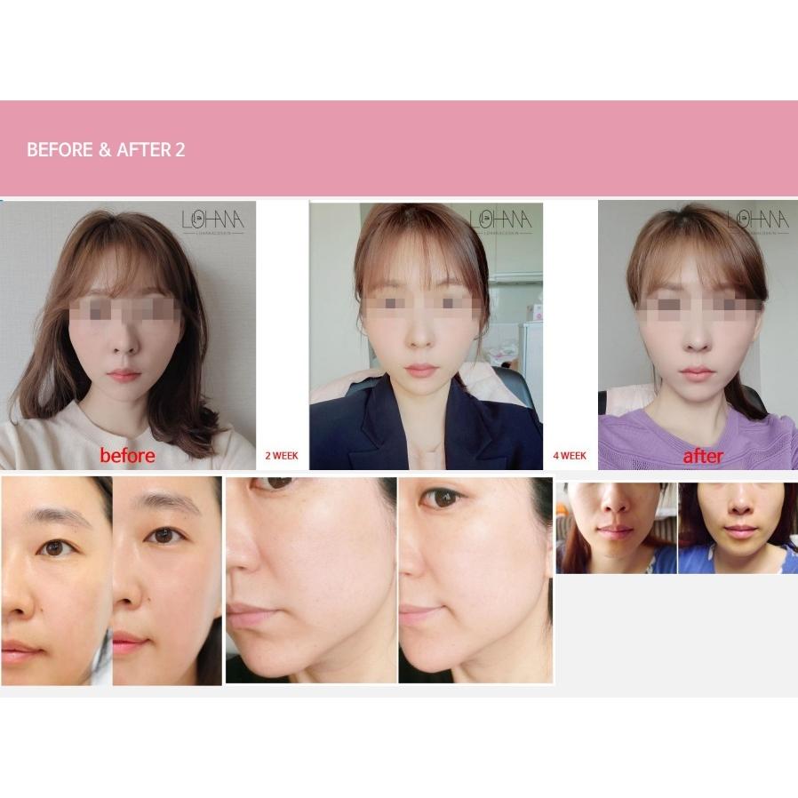 公認ストア】エルフェイス ELFACE 韓国 最新美顔器 メイクさんが使う