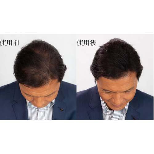 スーパーミリオンヘアー ダークブラウン ( 30g )/ スーパーミリオン