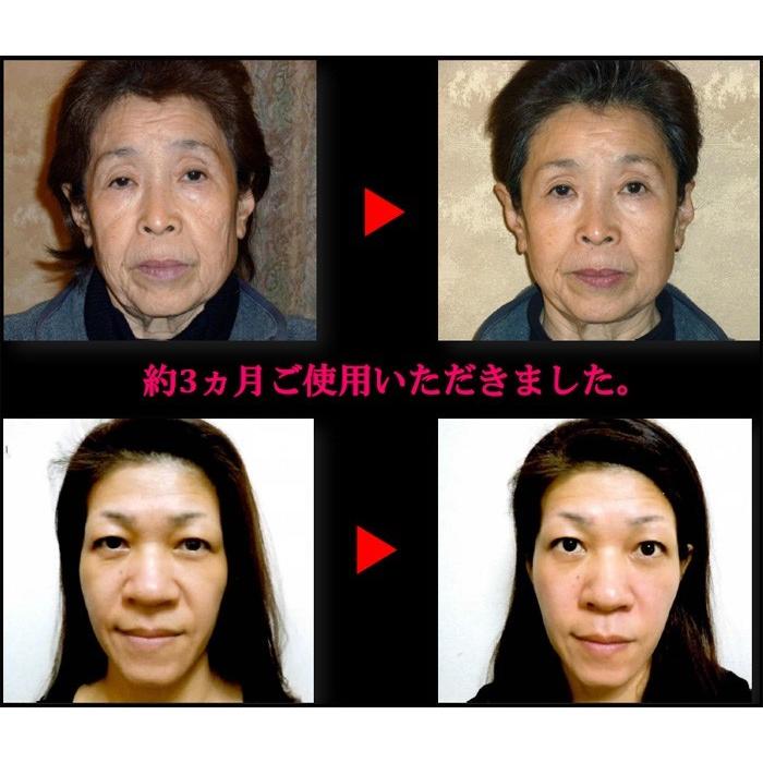 Pure Pulse II ( ピュアパルスII ) 期間限定 イビスコマーレ