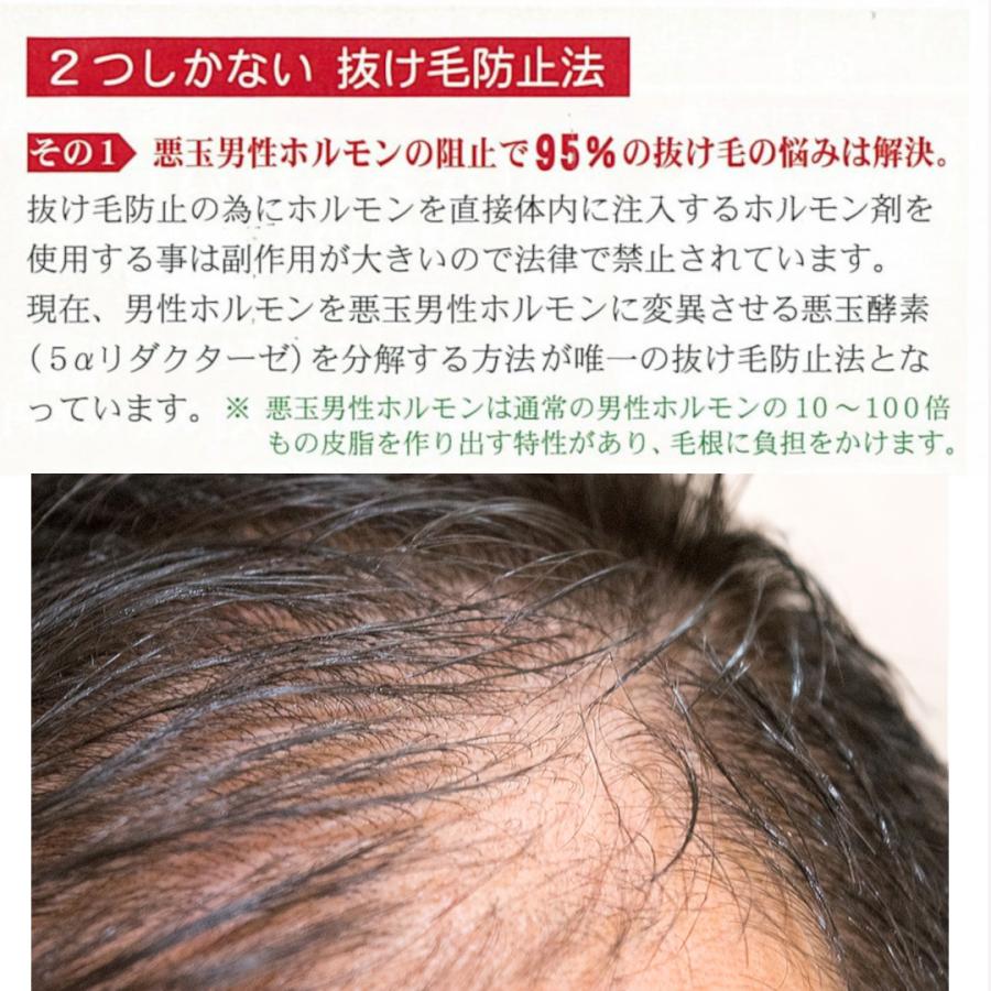 マミヤンアロエ マミヤンアロエ薬用トニック 150ml 3本セット 漢方 漢