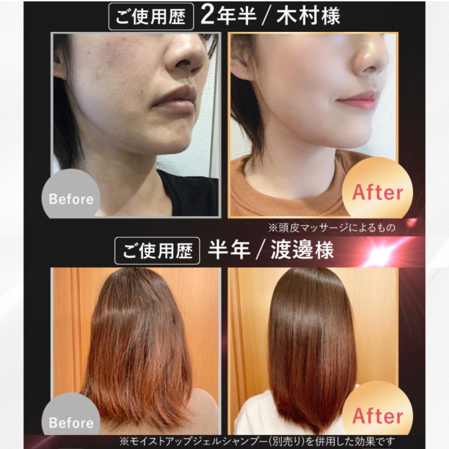 fuettarich（フエッタリッチ） スカルプ ヘッドスパ ems ブラシ 家電