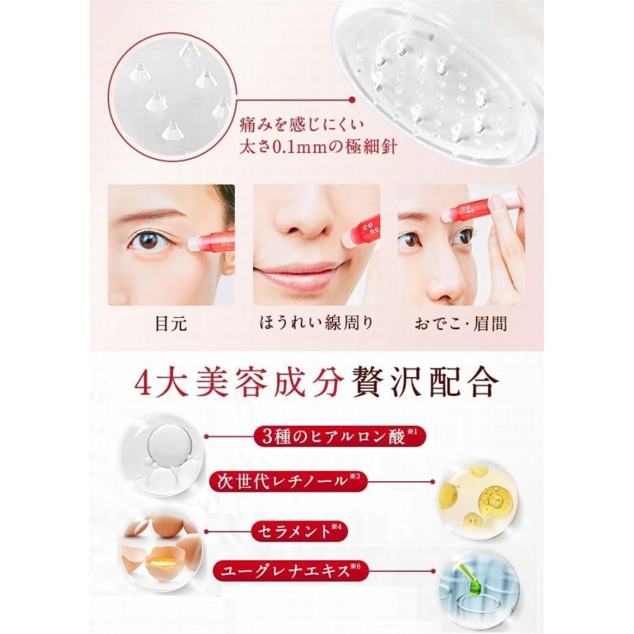 CONC リンクルインジェクション 2.5ml 《ヒアルロン酸、次世代