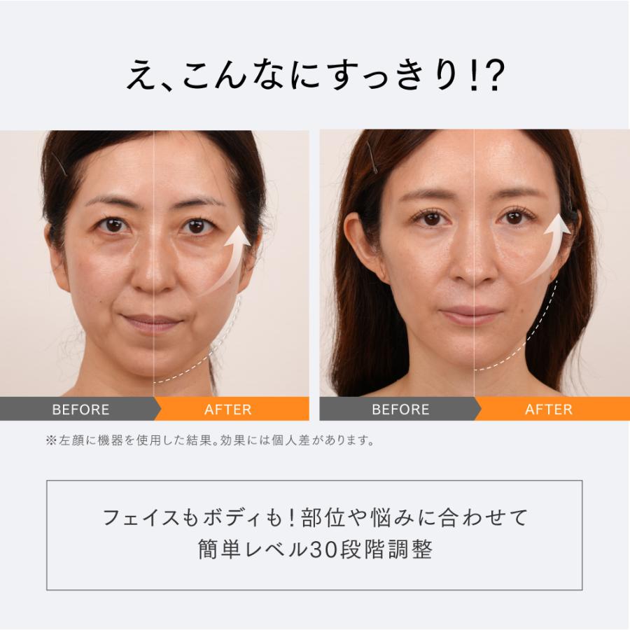 フェイスポイント ポスポス 美顔器 振動 リフトケア エイジングケア