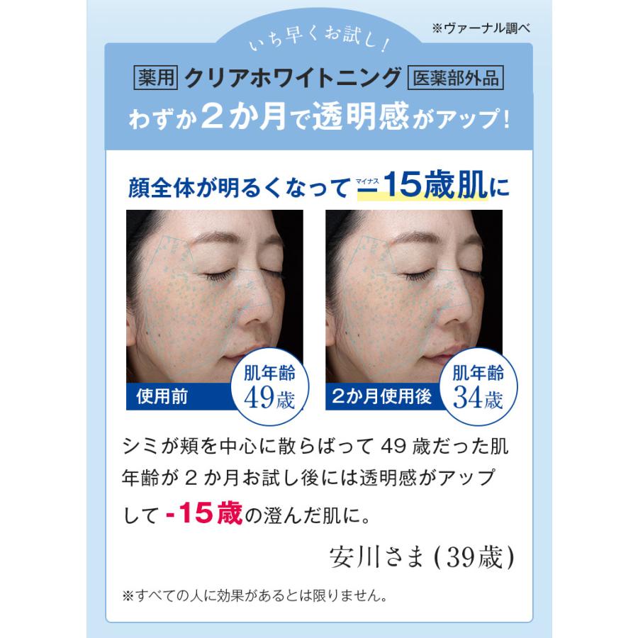 VERNAL（ヴァーナル） [薬用] クリアホワイトニング 100mL 美白 化粧水