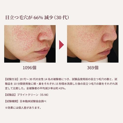 YA‐MAN（ヤーマン） スチーマー 毛穴ケアスチーマー ブライトクリーン