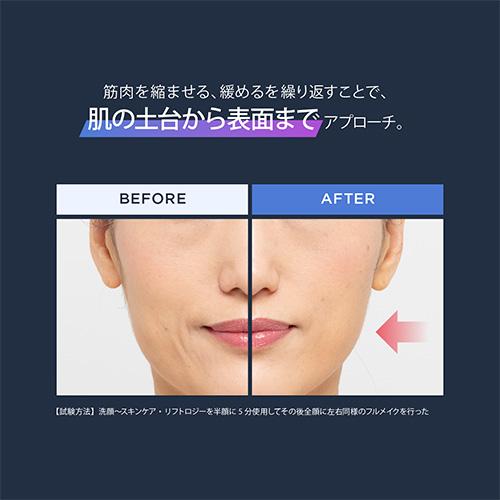 YA‐MAN（ヤーマン） 美顔器 リフトロジーSP 公式 リフトアップ