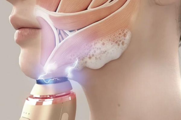 Buy ZOGANKIN OVO CL-ZKO for Skin Cleansing and Lifting