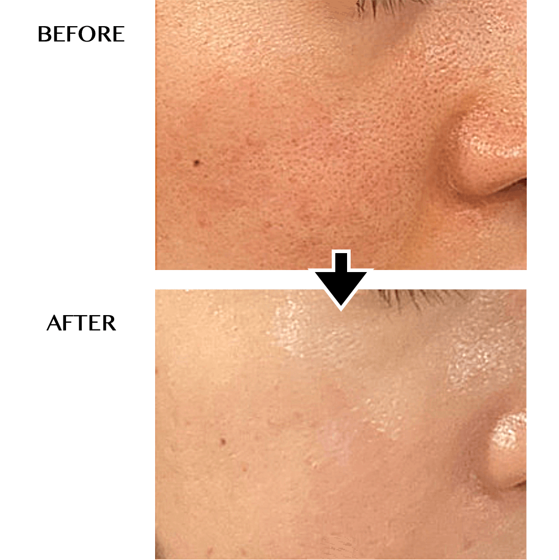 CELLZERO FAST | 「じぶんdeエステ」オンラインショップ【公式】