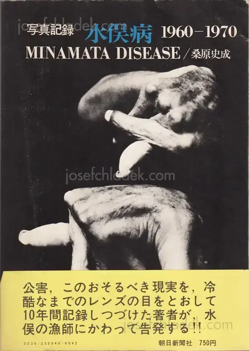 Shisei Kuwabara - Minamata Disease 1960-1970 (桑原 史成 写真記録