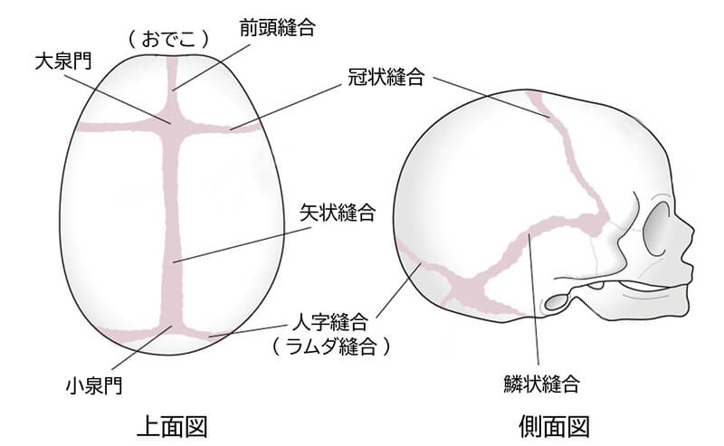頭蓋縫合早期癒合症｜日本形成外科学会