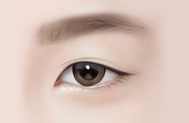 Upper Blepharoplasty - GRAND PLASTIC SURGERY