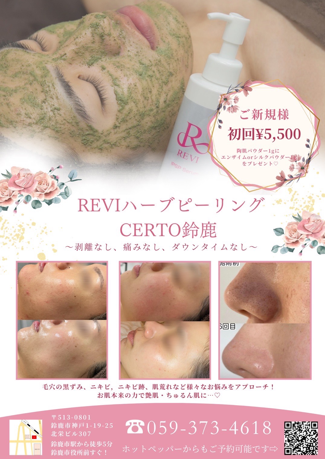 REVEハーブピーリングのお試しチャンス！ – 株式会社ケイズドリーム