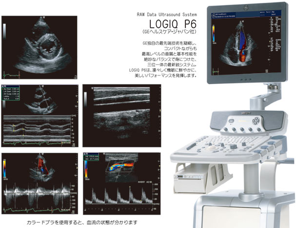 超音波（エコー）検査 | 蒲田内科クリニック