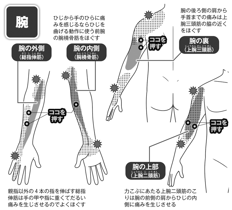 トリガーポイント》のマッサージで腕や手の慢性的な痛みを軽減 痛み