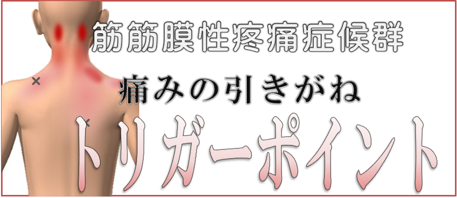 筋筋膜性疼痛症候群【MPS】痛みの引き金トリガーポイント｜痛みの事
