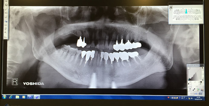 デジタルレントゲン | 風間歯科医院｜中野市・飯山市・須坂市・長野市