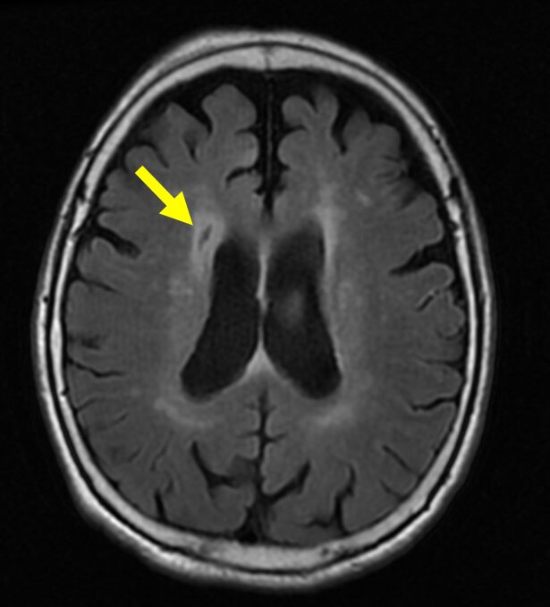 脳ドックMRIの選び方】どこも同じじゃない？検査内容と価格の違いとは