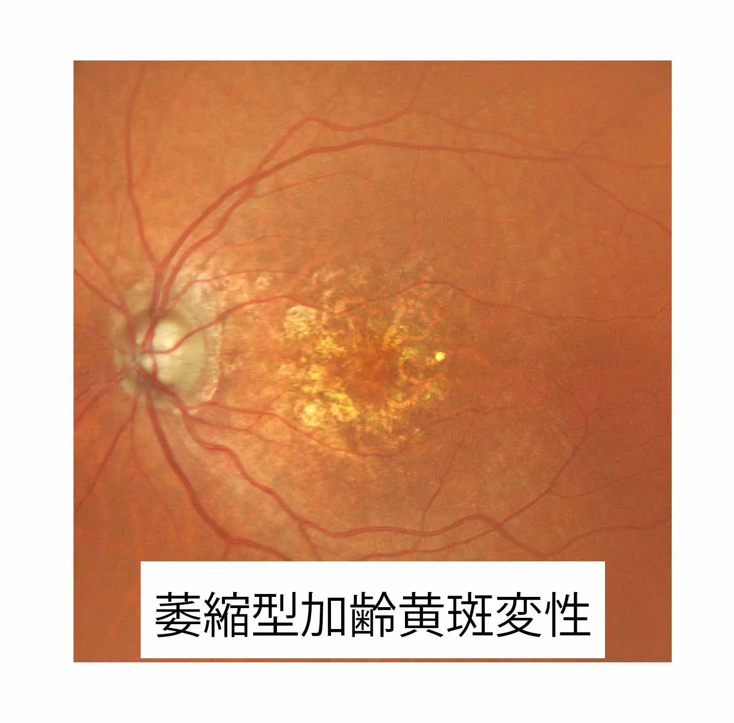 e68047d2d41cf33e8dd7ab9b0a5835