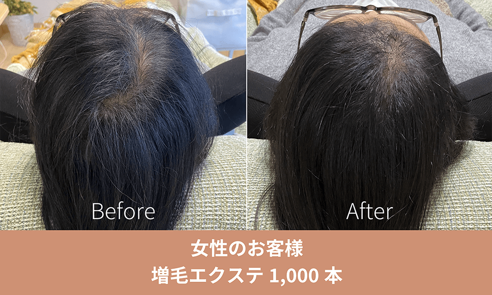 増毛エクステサロン きのした｜ご新規様1000本4680円(税込)でご提供