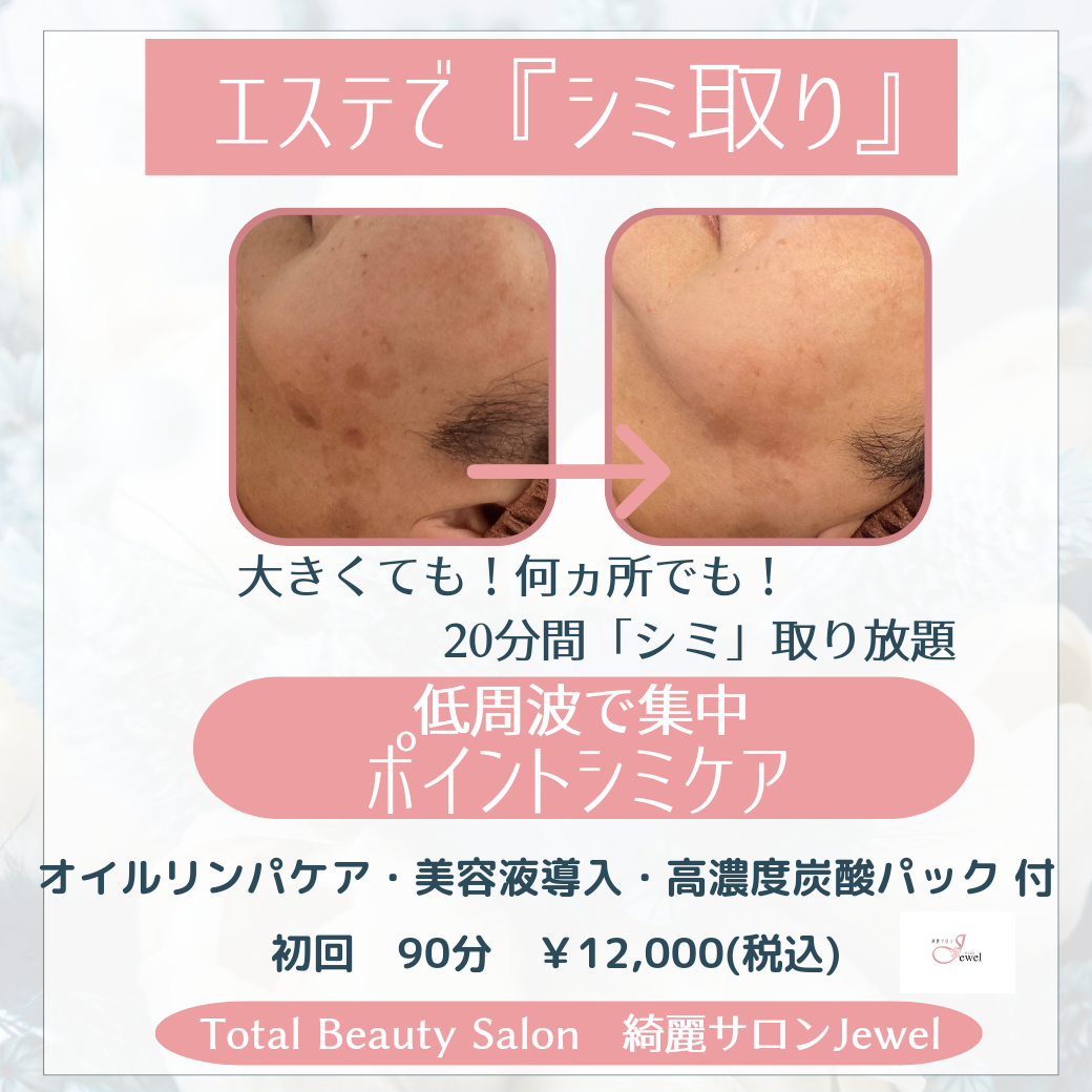 20分間🔹シミ取り放題🔹低周波で集中シミケア🔹横浜市都筑区センター北