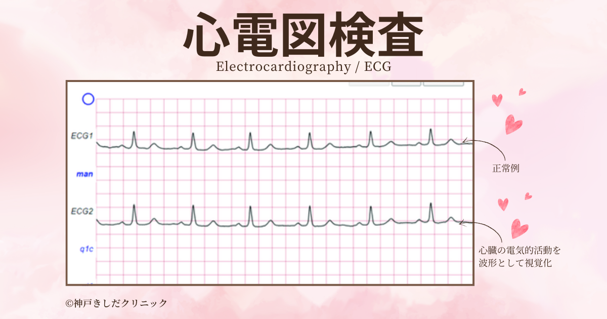 心電図検査（心電図 / Electrocardiography / ECG または EKG） - 神戸