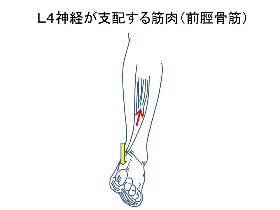 ヘルニアと診断されたあなたへ・・こんな症状でていませんか？ – 朝霞