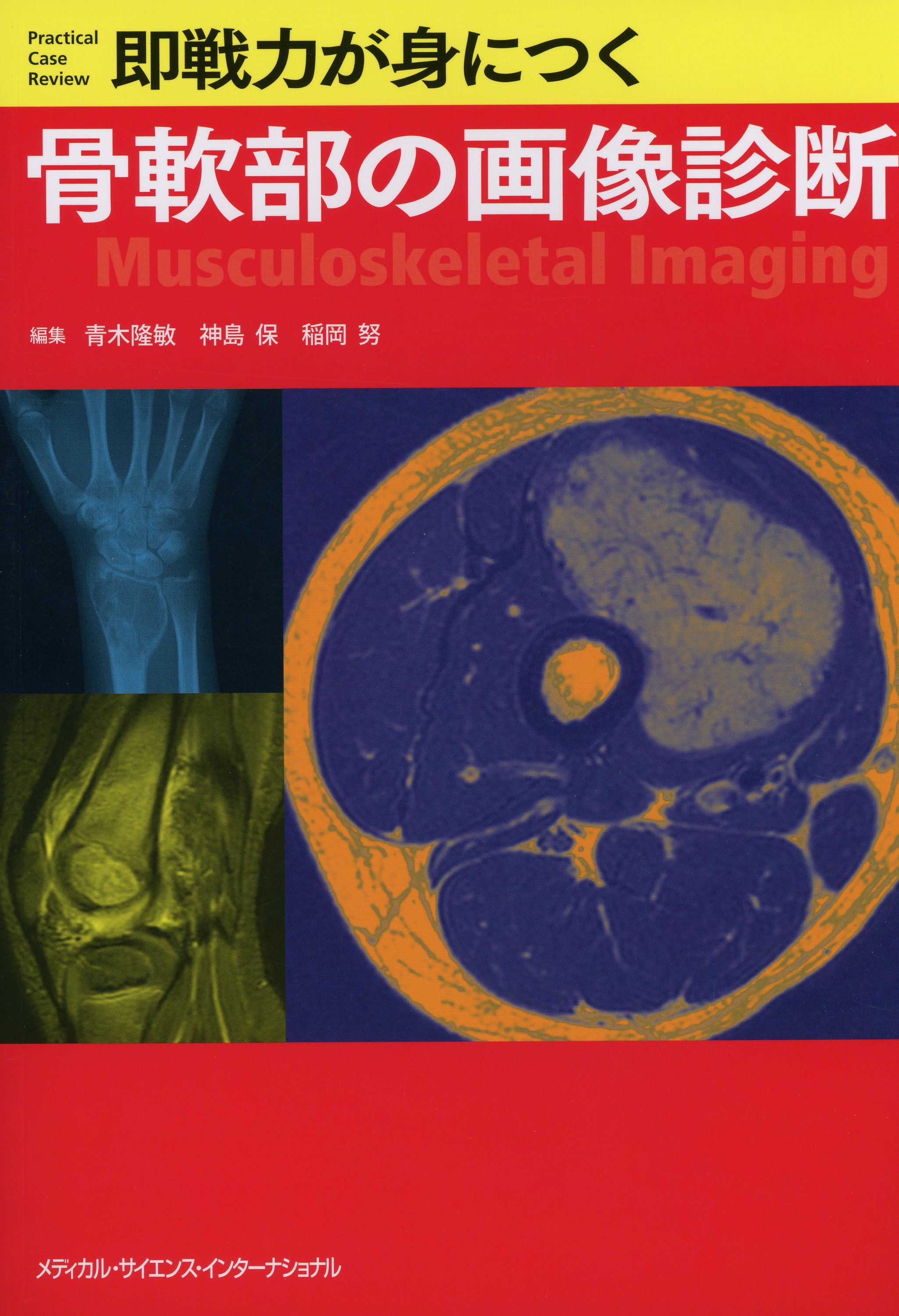 即戦力が身につく骨軟部の画像診断 / 高陽堂書店