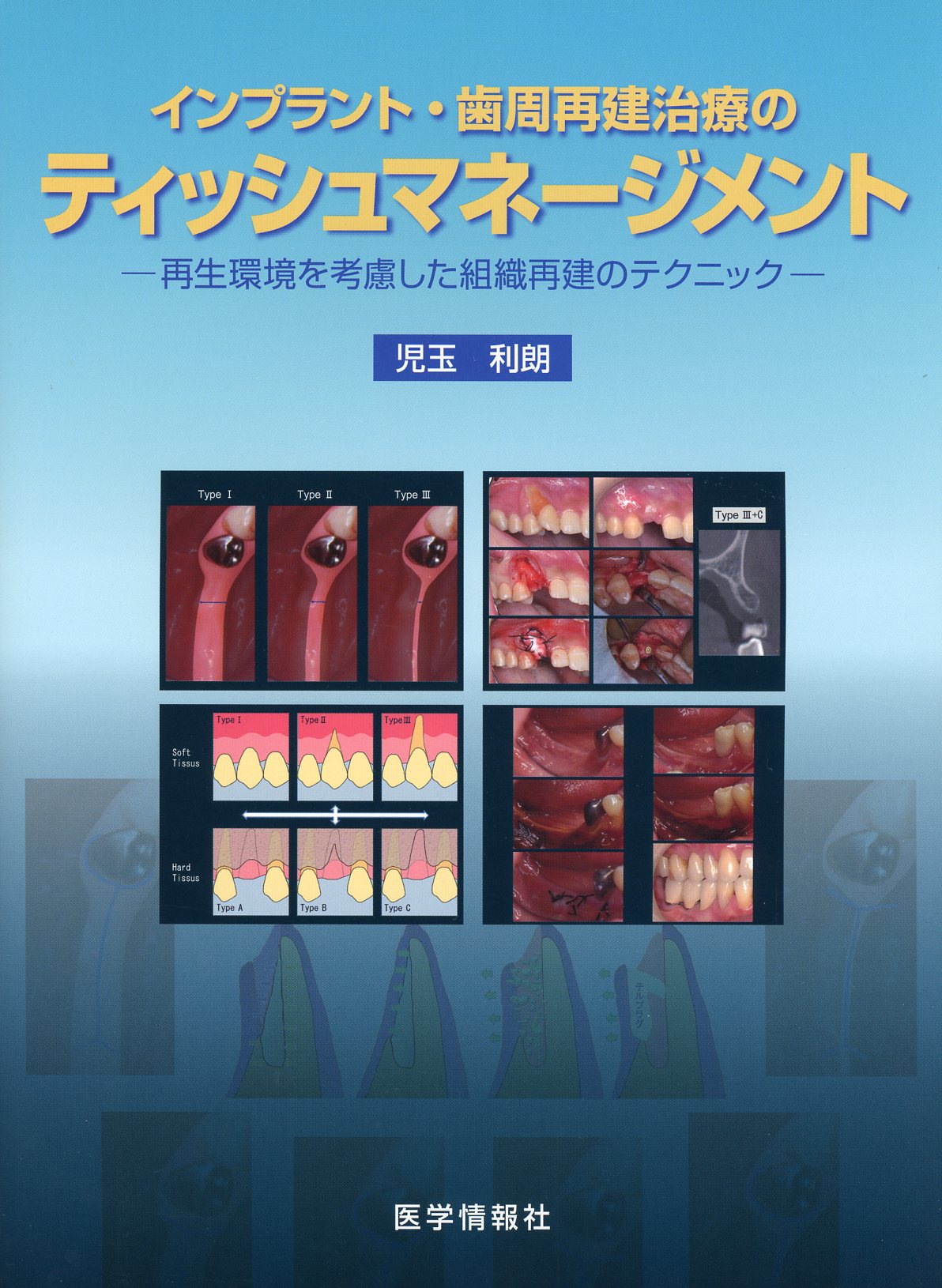 インプラント・歯周再建治療のティッシュマネージメント 再生環境を