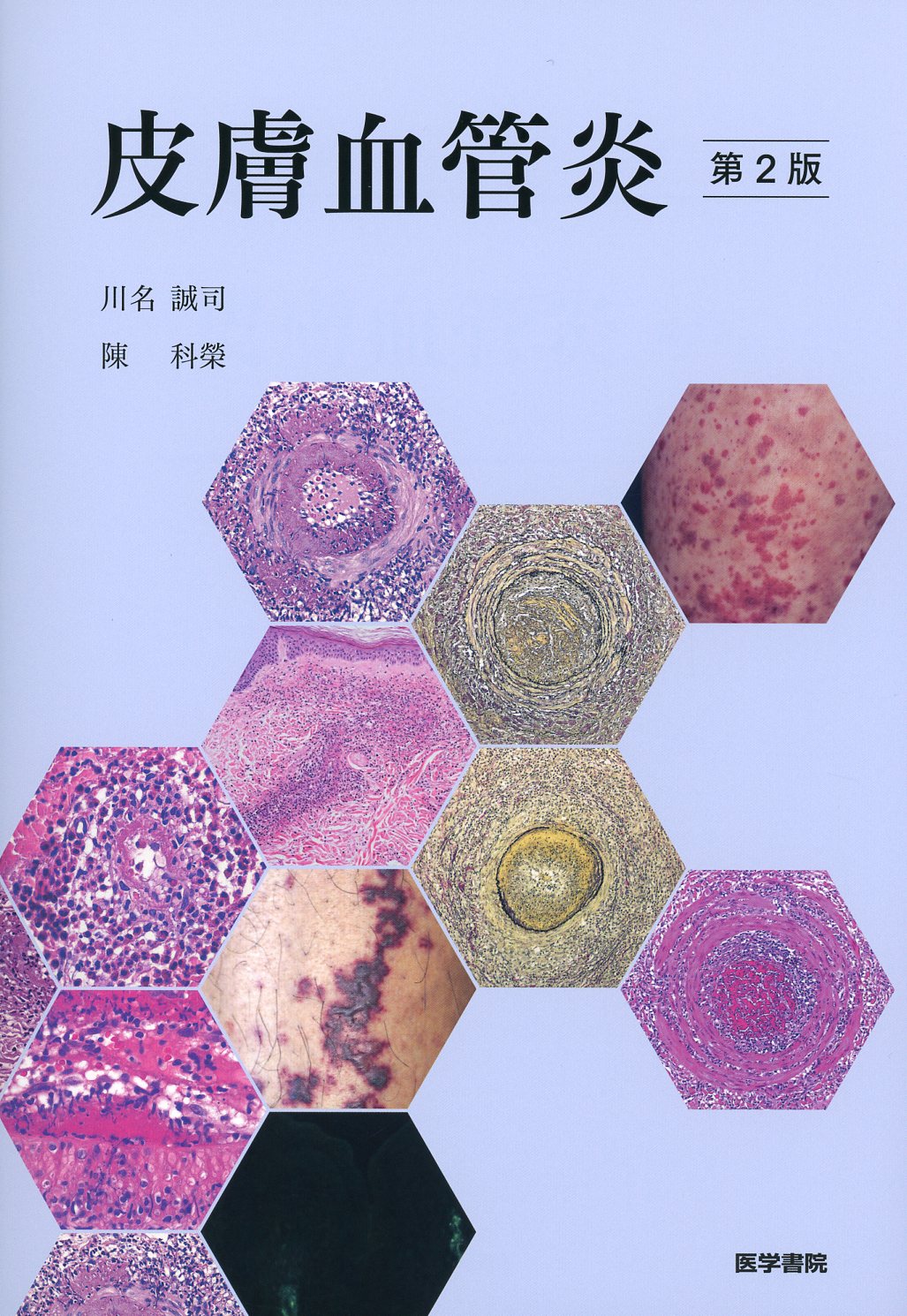 皮膚血管炎 第2版 / 高陽堂書店