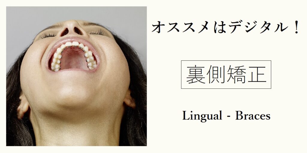 裏側矯正（リンガル矯正） - 矯正歯科が渋谷で安いとおすすめTBDC東京